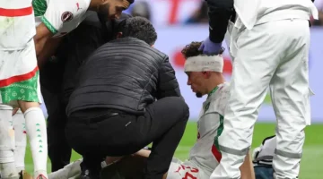 نزيف بالوجه.. إصابة قوية لنجم منتخب المغرب في مواجهة مثيرة أمام السنغال